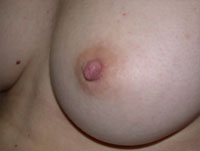 Inverted Nipple Repair Southern California