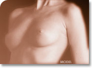 About Nipple & Areola Correction
